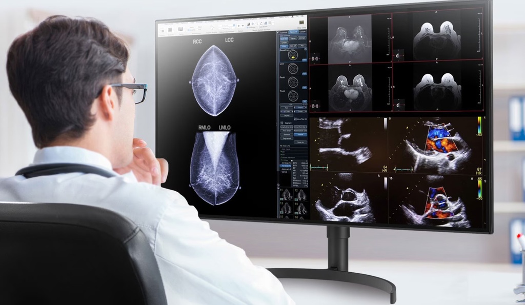 LG 32" 32HL512D-B IPS Diagnostic, Multi-Input, PBP,  Height Adjust, Realistic Colour, Pathology Mode, Monitor. Project and Professional
